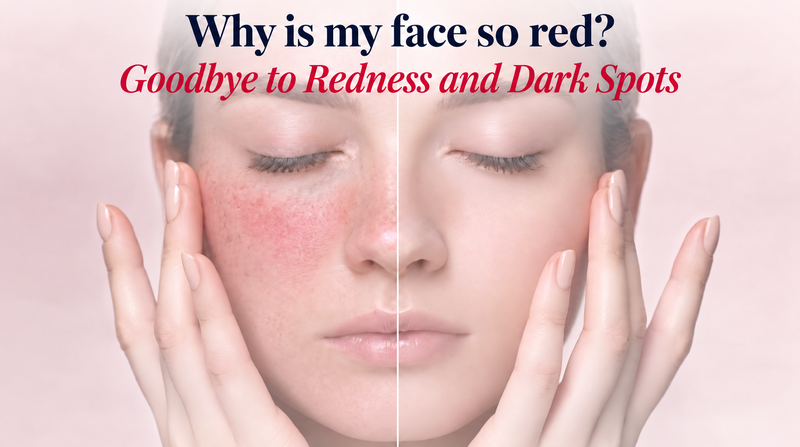 Why is my face so red? 5 K-Beauty ingredients for redness and dark spots