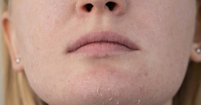 Dehydrated Skin? Meet Panthenol — Your New Skincare MVP With Piyonna