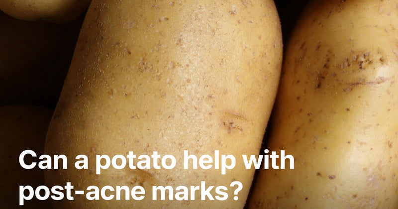 Can a potato help with acne marks? Discover a pad against acne marks — now at Piyonna