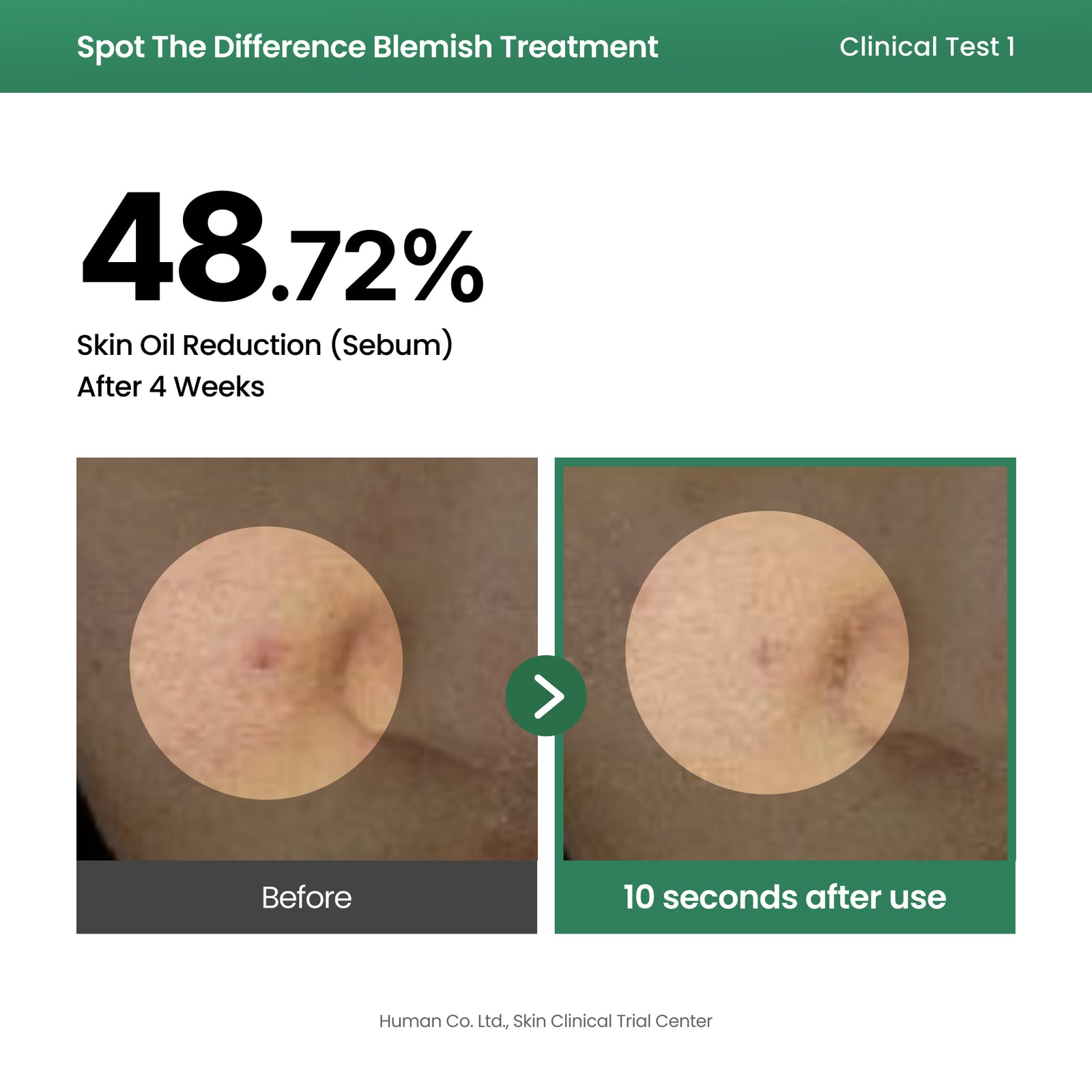piyonna Spot The Difference Blemish Treatment Soins visage Sérum