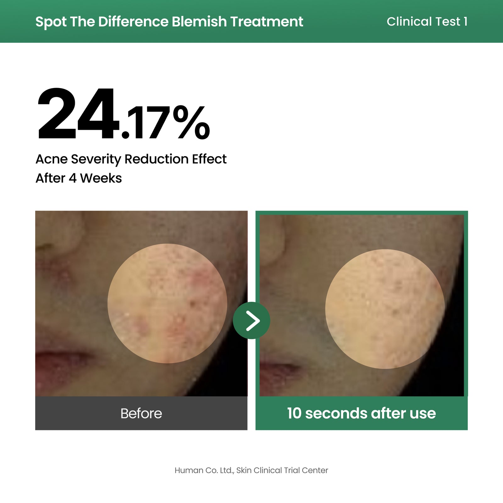 piyonna Spot The Difference Blemish Treatment Soins visage Sérum