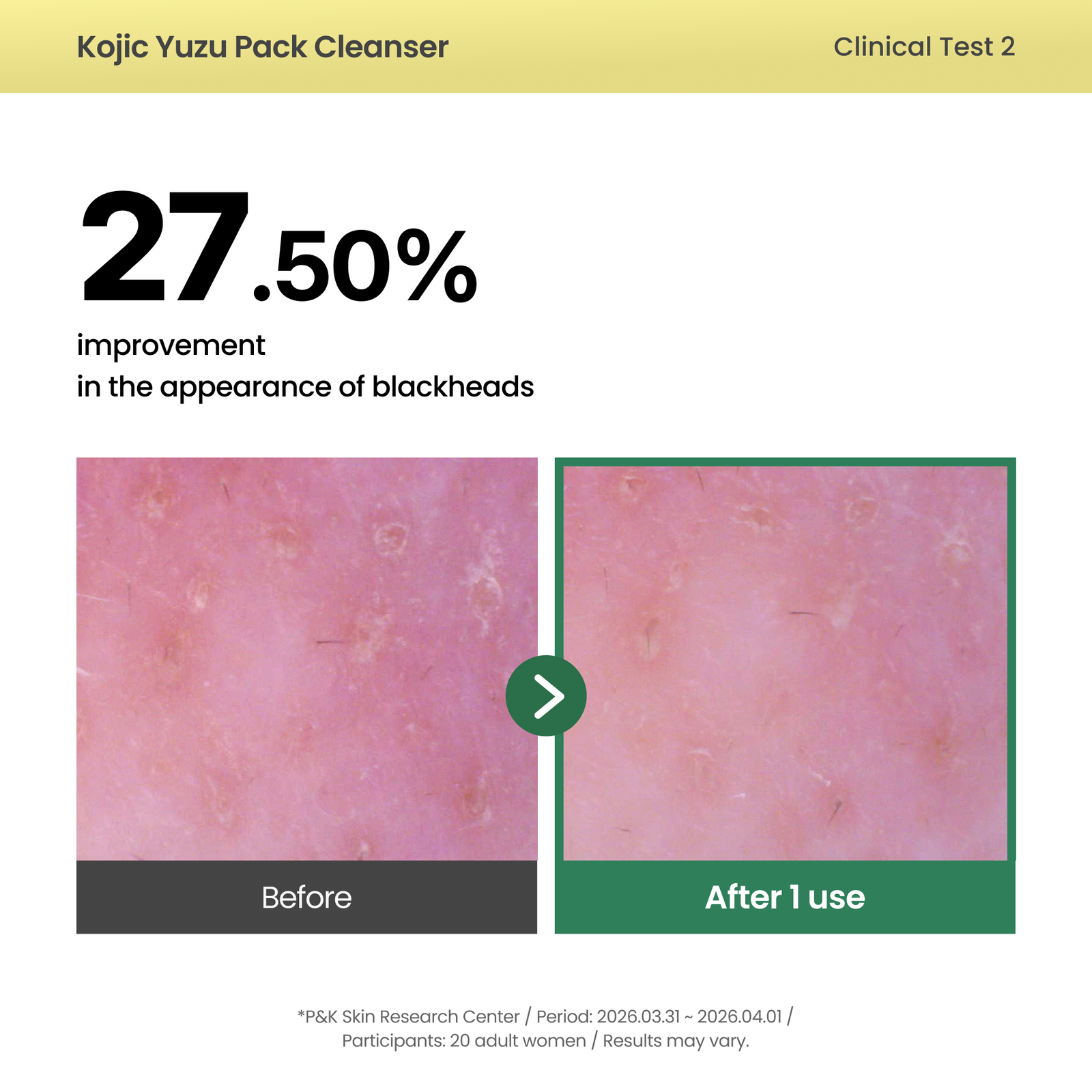 piyonna Kojic Yuzu Pack Cleanser Soins visage Démaquillage Mousse nettoyante