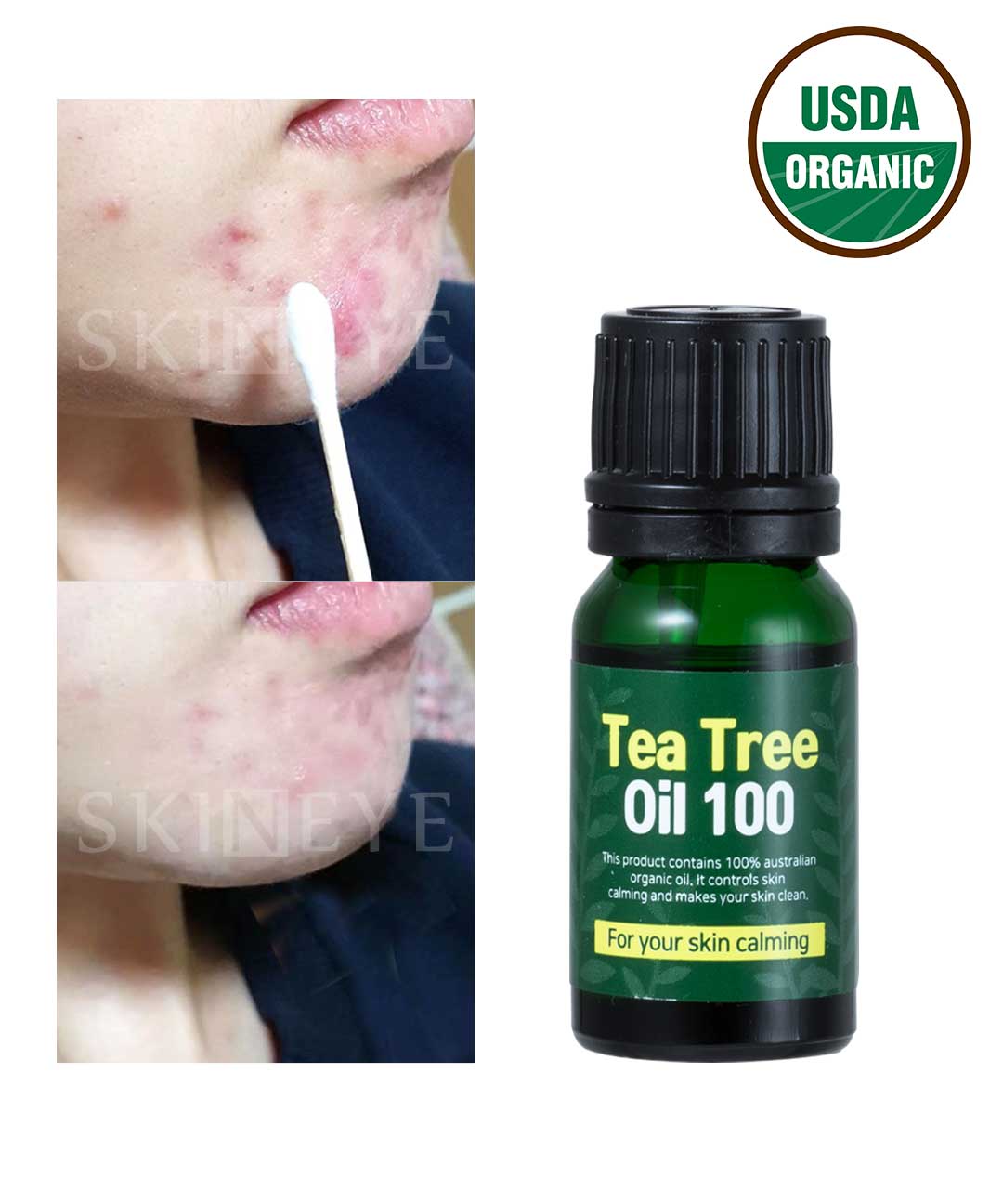 piyonna Organic Tea Tree Oil 100 Intensive Calming Oil Face Care Face Oil