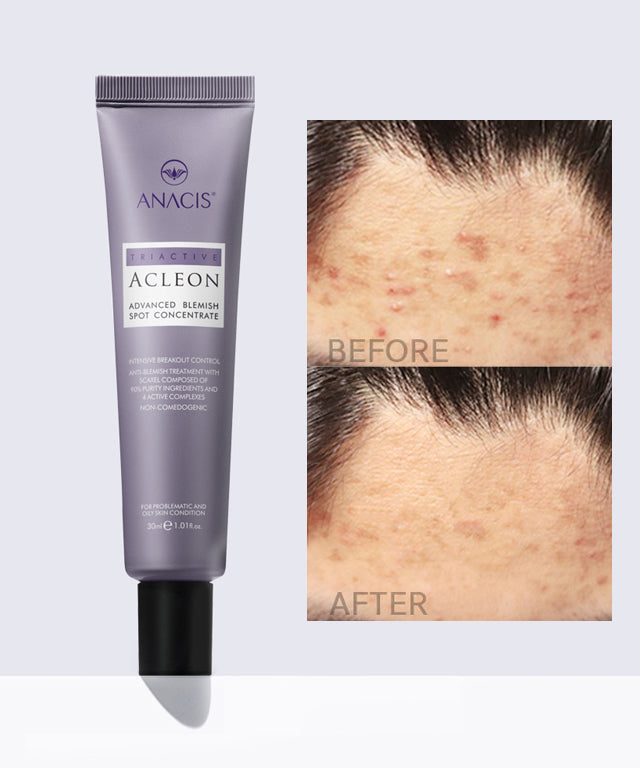 piyonna Acleon Acne Trouble Spot Cream Face Care Serum