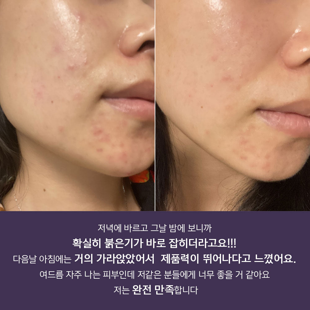 piyonna Acleon Acne Trouble Spot Cream Face Care Serum