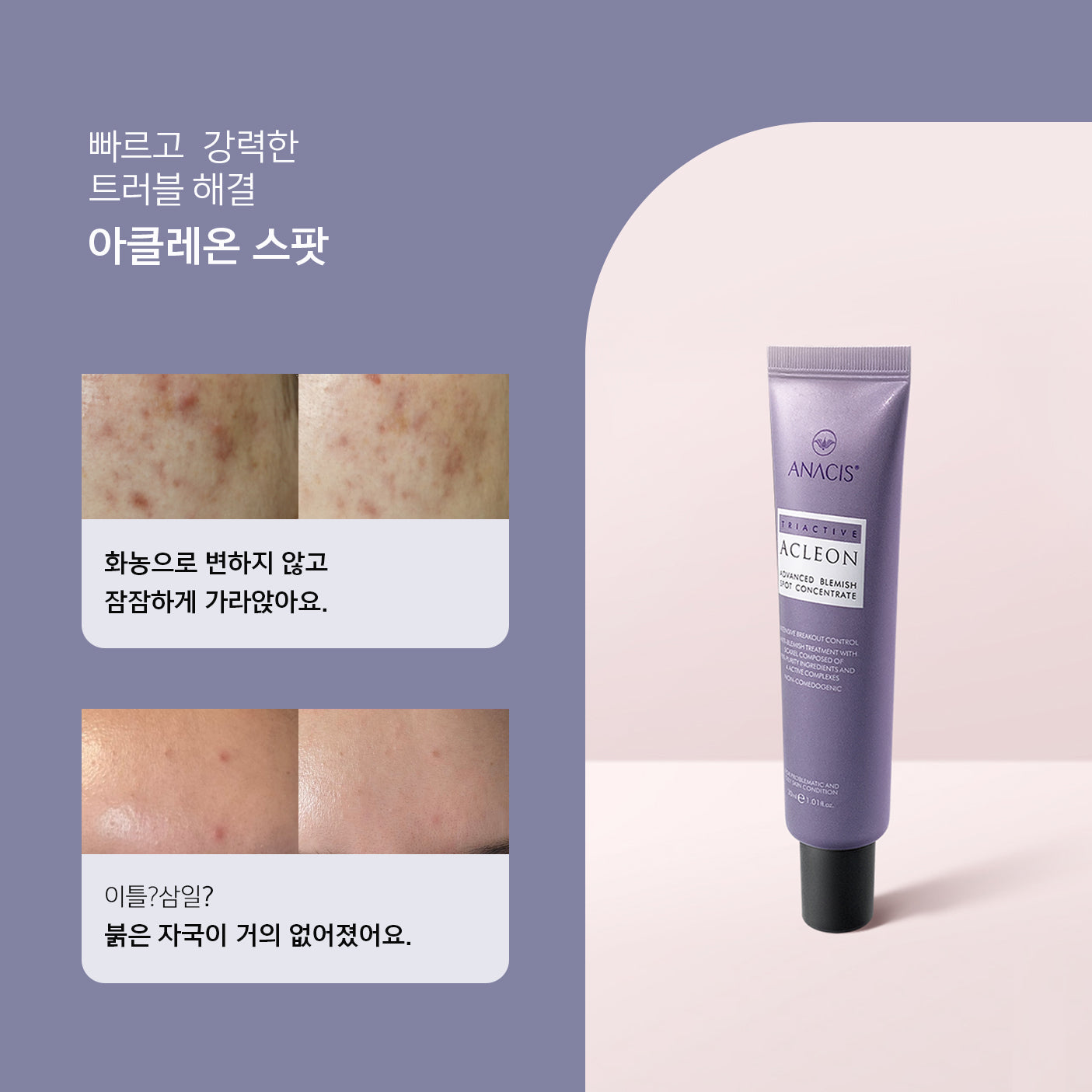 piyonna Acleon Acne Trouble Spot Cream Face Care Serum
