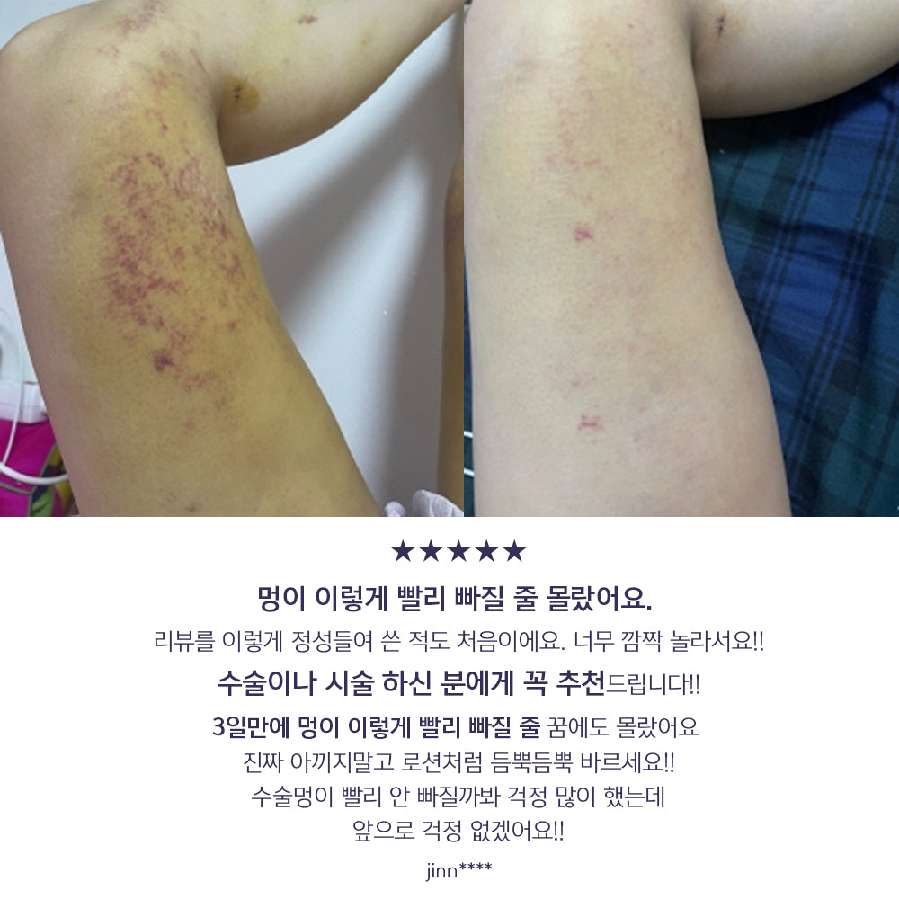 piyonna K-Oxiderm Vitamin K Oxide Bruise Cream Face Care Cream
