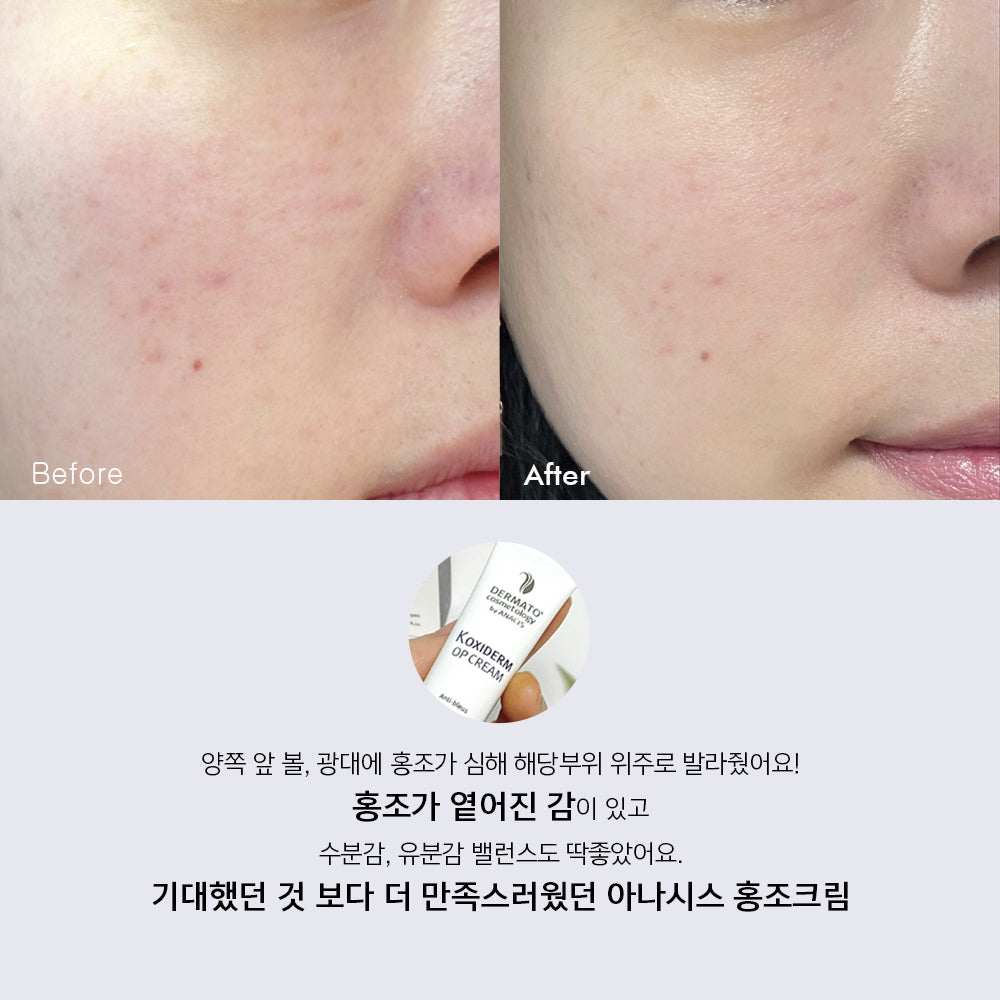 piyonna K-Oxiderm Vitamin K Oxide Bruise Cream Face Care Cream