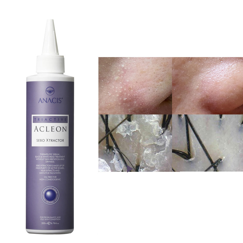 piyonna Acleon Blackhead Pore Sebum Softener Face Care Cleanser Exfoliator