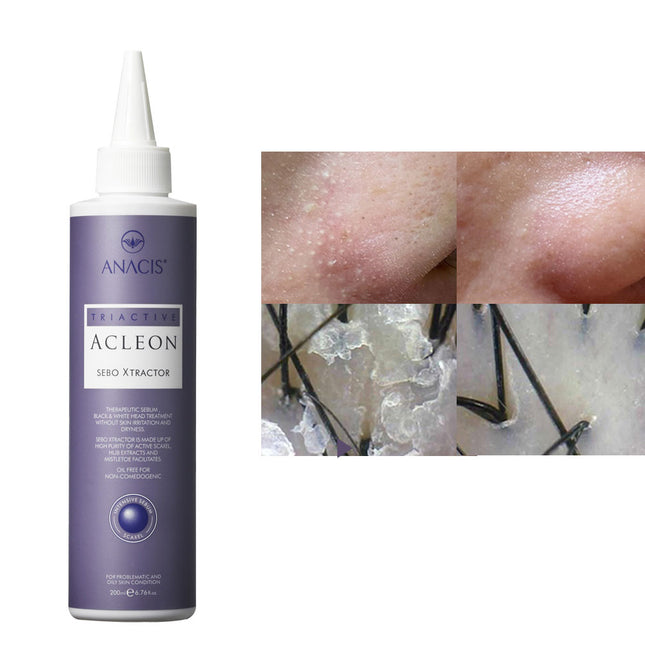 piyonna Acleon Sebo Xtractor (Pore Sebum Softener) Face Care Cleanser Exfoliator