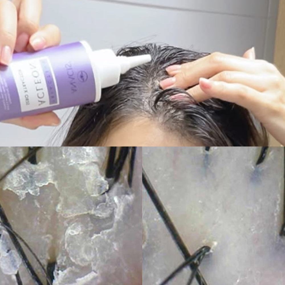 piyonna Acleon Blackhead Pore Sebum Softener Face Care Cleanser Exfoliator