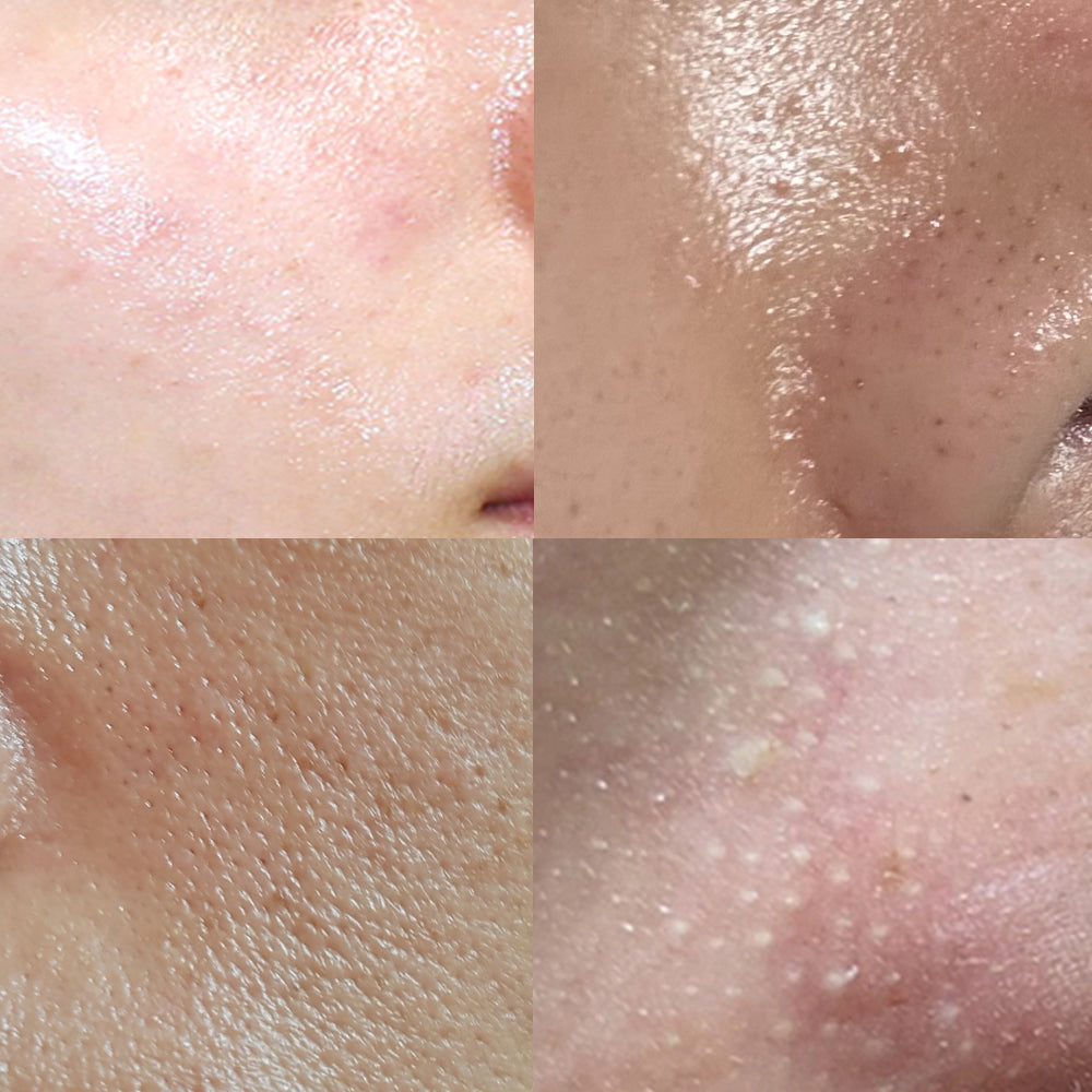 piyonna Acleon Blackhead Pore Sebum Softener Face Care Cleanser Exfoliator