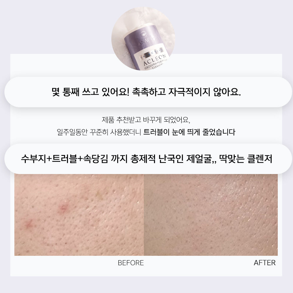 piyonna Acleon Oily Skin Salicylic Acid Cleansing Foam 200ml Face Care Cleanser Cleansing Foam