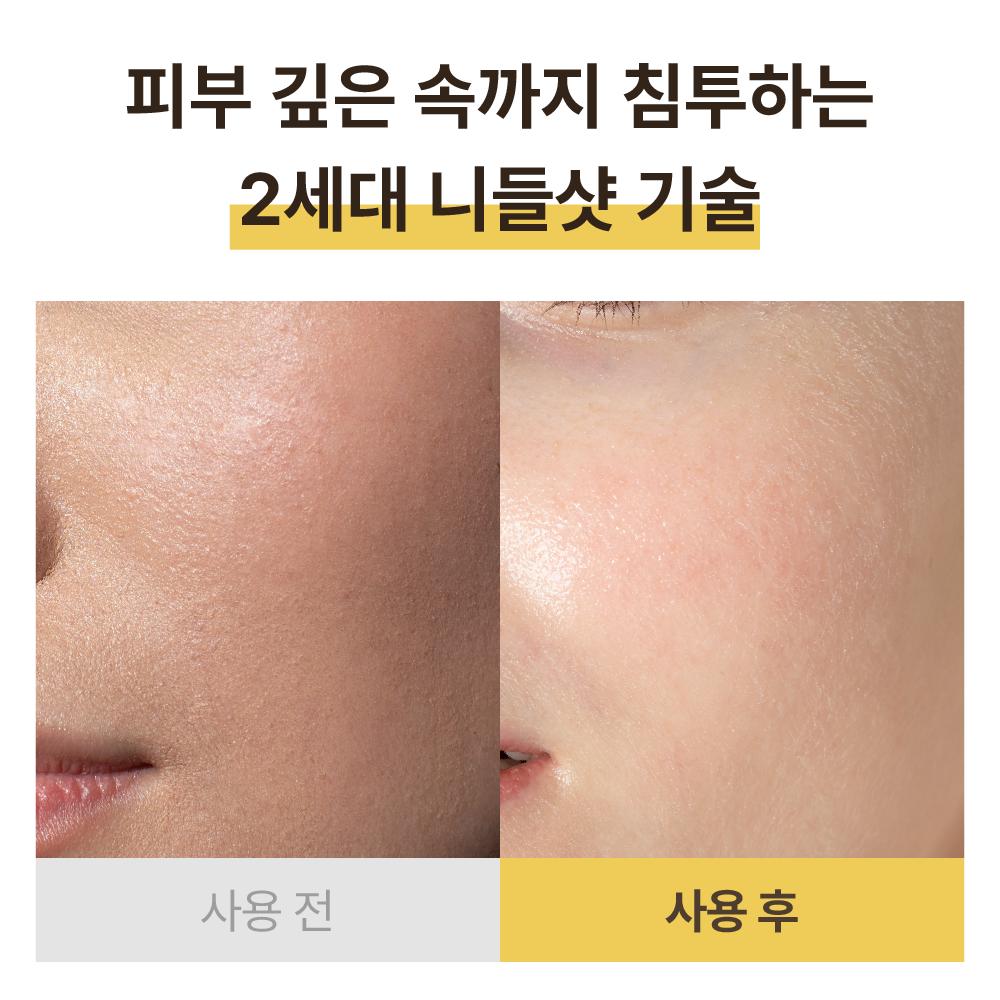 piyonna Dr. JSK PDRN Capsule Needle Shot Essence 30ml Face Care Serum