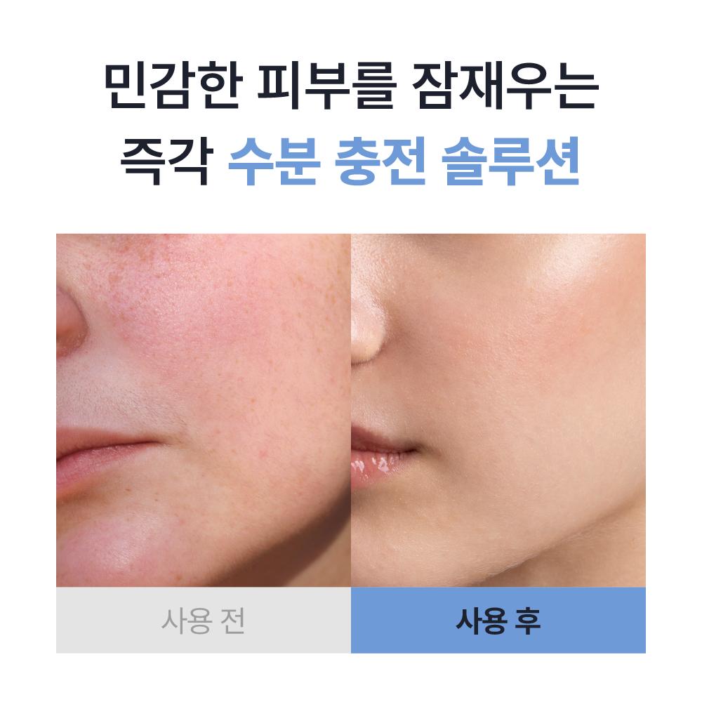 piyonna Dr JSK PDRN Repair Hyaluron Essence 30ml Soin de la peau Lotion Sérum, Essence & Ampoule